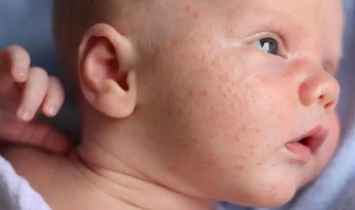 1.1 Tác nhân bên trong 1.1 Tác nhân bên trong