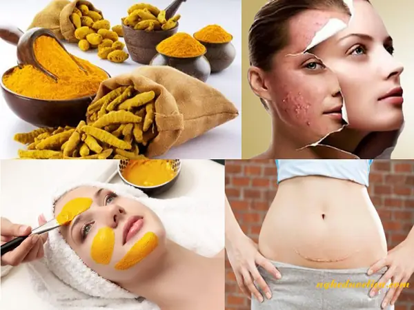 Điều Quan Trọng Khi Dùng Tinh Bột Nghệ Đắp Mặt Để Chăm Sóc Da