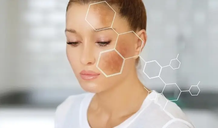 Mục Đích Đắp Mặt Nạ Sữa Ong Chúa Mục Đích Đắp Mặt Nạ Sữa Ong Chúa