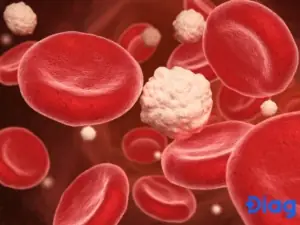 Biến Chứng Cấp Tính Biến Chứng Cấp Tính