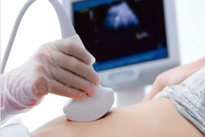 Gói xét nghiệm sàng lọc trước sinh