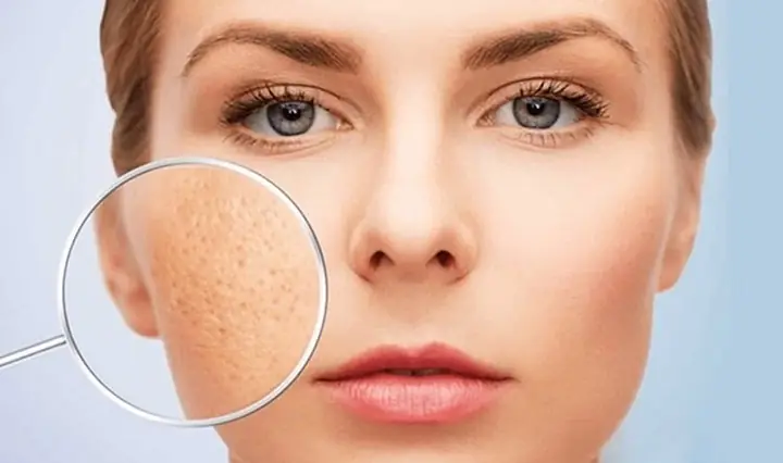 1.3 Sự thay đổi của da hỗn hợp theo mùa