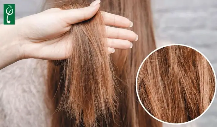 Tóc khô và xơ Tóc khô và xơ