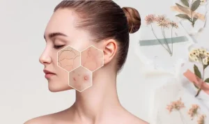 1Thế nào là da nhạy cảm?