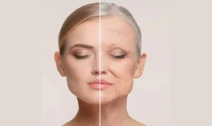 1.8. Hỗ trợ cải thiện và hạn chế nếp nhăn