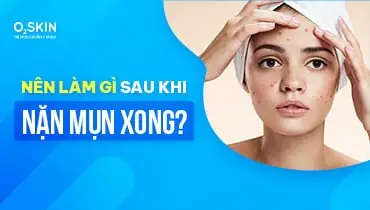 Nặn Mụn Xong Bị Sưng Đỏ Nên Làm Gì