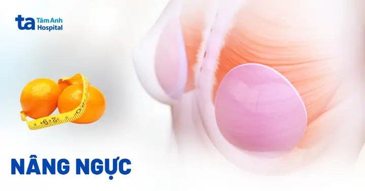 Phẫu Thuật Nâng Ngực: Chỉ Định, Quy Trình Thực Hiện Và Các Thắc Mắc Phẫu Thuật Nâng Ngực: Chỉ Định, Quy Trình Thực Hiện Và Các Thắc Mắc