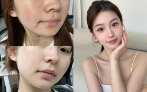 Nếu bạn đang tìm kiếm một sản phẩm toner đa nhiệm, hãy tham khảo ngay 5 gợi ý dưới đây.