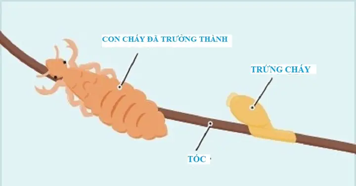 Con Chấy Sinh Sản Như Thế Nào? Trứng Chấy Như Thế Nào? Con Chấy Sinh Sản Như Thế Nào? Trứng Chấy Như Thế Nào?