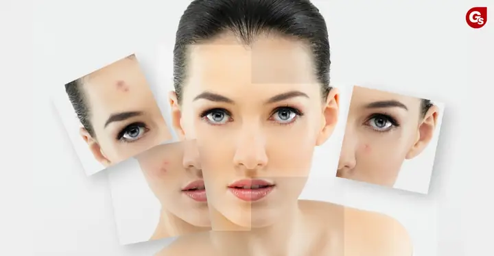 Bao-nhieu-tuoi-nen-uong-collagen-gymstore-1