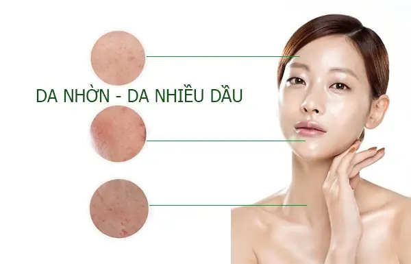 Nguyên Nhân Và Cách Nhận Biết Da Dầu
