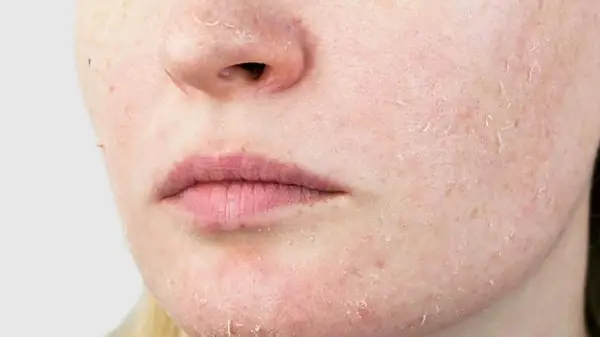 Cách Dùng Gel Tẩy Tế Bào Chết Da Mặt