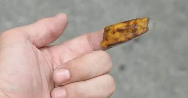 Tội Gì Phải Lấy Kim Nhổ Dằm Cho Đau Khi Đã Có 5 Mẹo Sau