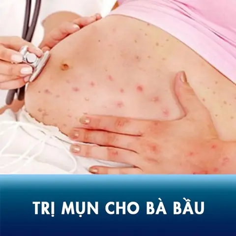 Nguyên Nhân Gây Mụn Lưng Khi Mang Thai Nguyên Nhân Gây Mụn Lưng Khi Mang Thai