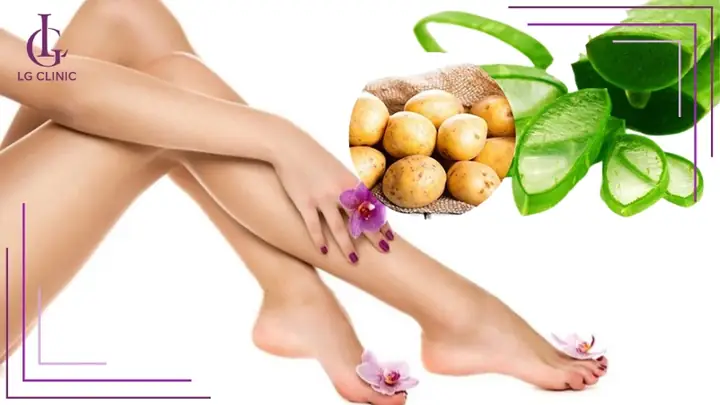 Triệt Lông Chân Tại Nhà Bằng Khoai Tây Và Nha Đam Triệt Lông Chân Tại Nhà Bằng Khoai Tây Và Nha Đam