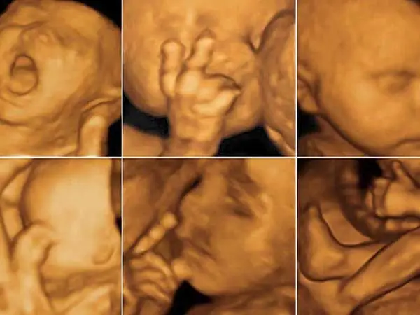 Siêu Âm 4d Thai 21 Tuần Là Gì? Siêu Âm 4d Thai 21 Tuần Là Gì?