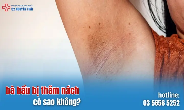 Bà Bầu Bị Thâm Nách Có Nguy Hiểm Không?