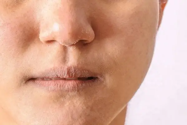 Không Bôi Kem Dưỡng Ẩm Có Sao Không? Không Bôi Kem Dưỡng Ẩm Có Sao Không?