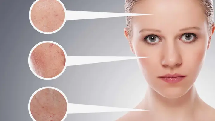 Mặt Nạ Ngũ Hoa Có Tác Dụng Gì Cho Làn Da? - Nhà Thuốc Fpt Long ... Mặt Nạ Ngũ Hoa Có Tác Dụng Gì Cho Làn Da? - Nhà Thuốc Fpt Long ...