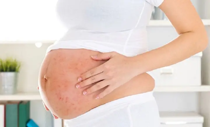 Một Số Biểu Hiện Ở Mẹ Bầu Khi Thai 35 Tuần Tuổi