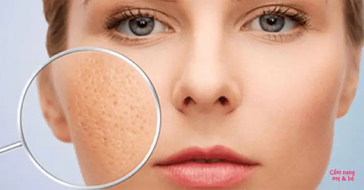 Top 10 Kem Dưỡng Se Khít Lỗ Chân Lông Hiệu Quả Nhất Hiện Nay Top 10 Kem Dưỡng Se Khít Lỗ Chân Lông Hiệu Quả Nhất Hiện Nay