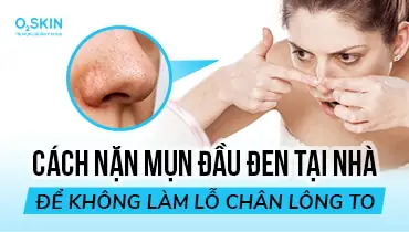 Làm Sạch Mụn Đầu Đen Với Kem Đánh Răng