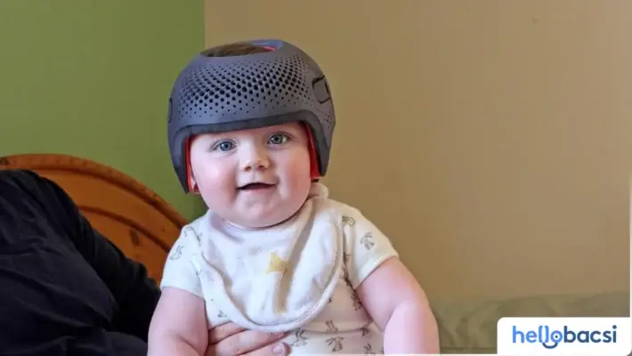 Mẹo Đụng Đầu Vào Tường Chữa Méo Đầu Cho Trẻ Sơ Sinh Có Như Lời ... Mẹo Đụng Đầu Vào Tường Chữa Méo Đầu Cho Trẻ Sơ Sinh Có Như Lời ...