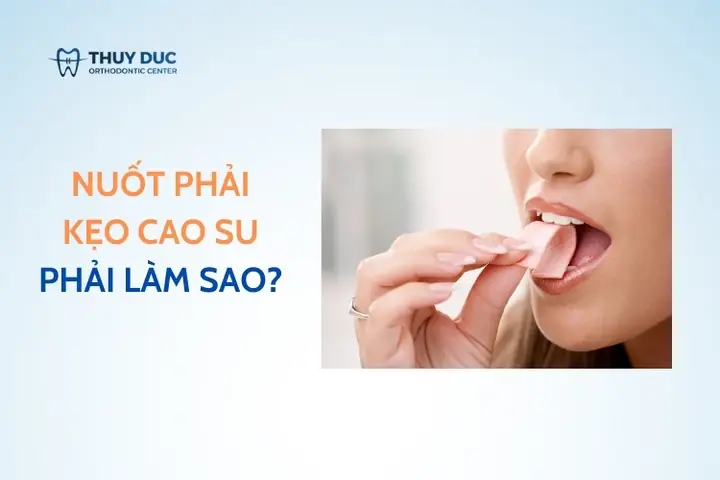 Sau Khi Nuốt Kẹo Cao Su Nên Làm Gì? Sau Khi Nuốt Kẹo Cao Su Nên Làm Gì?