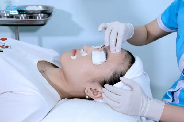 Peel Da Xong Có Nên Đắp Mặt Nạ