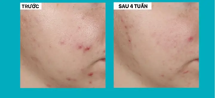 Hiệu Quả Đáng Mong Đợi: Hiệu Quả Đáng Mong Đợi: