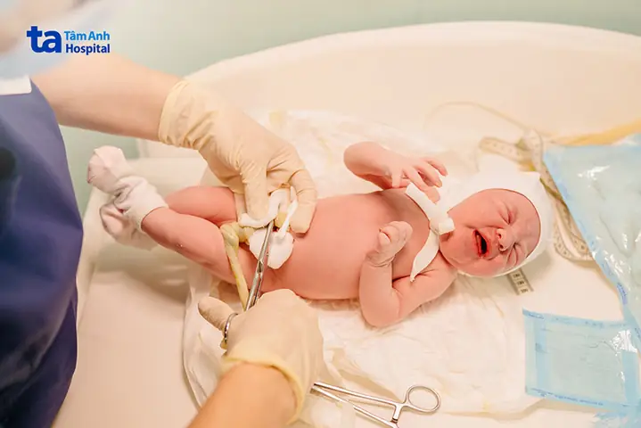 Vì Sao Cần Chăm Sóc Rốn Cho Trẻ Sơ Sinh?