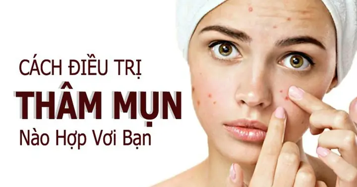 Top 9 Kem Trị Thâm Mụn Lâu Năm Cho Làn Da Tươi Sáng Đều Màu