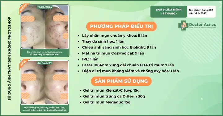 Tác Dụng Phụ Và Một Số Lưu Ý Khi Sử Dụng Tinh Dầu Tràm Trà Tác Dụng Phụ Và Một Số Lưu Ý Khi Sử Dụng Tinh Dầu Tràm Trà