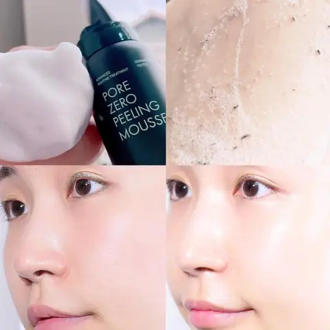 Tẩy Da Chết Vật Lí Dạng Mask