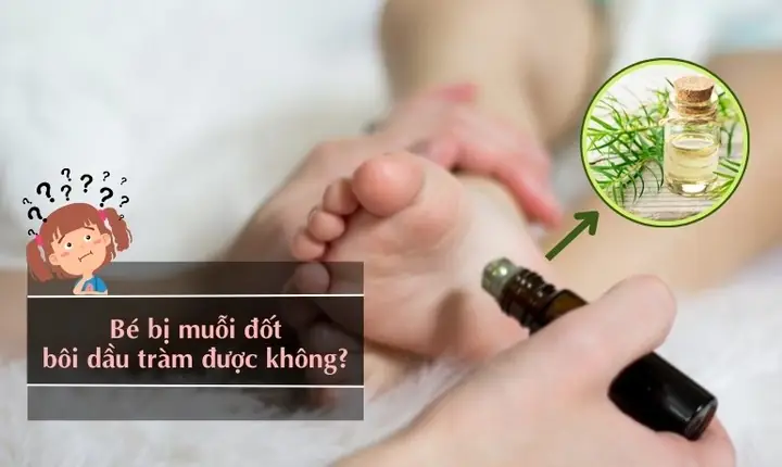 Bé Bị Muỗi Đốt Bôi Dầu Tràm Được Không? Lưu Ý Khi Dùng – Natonic ... Bé Bị Muỗi Đốt Bôi Dầu Tràm Được Không? Lưu Ý Khi Dùng – Natonic ...