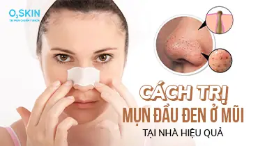 Trộn Kem Đánh Răng Với Muối Trị Mụn Đầu Đen