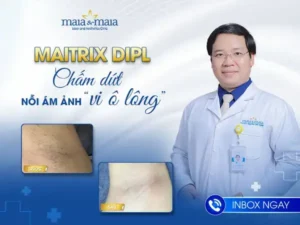 Phương Pháp Thay Thế Dọn Sạch Lông Vùng Nách Hiệu Quả Cao