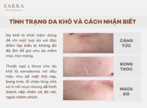 Tình Trạng Da Khô Và Cách Nhận Biết